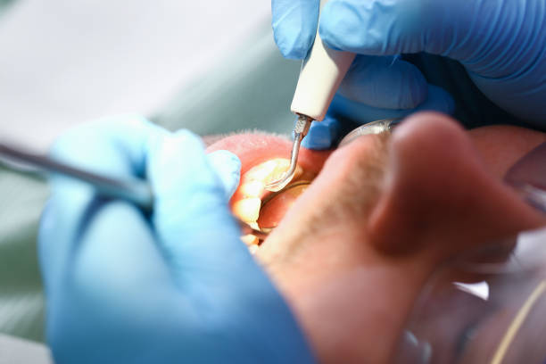 Best Cracked Tooth Emergency Dentist  in Brewster Hill, NY